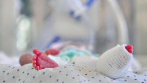 mortalidad infantil jul 2017